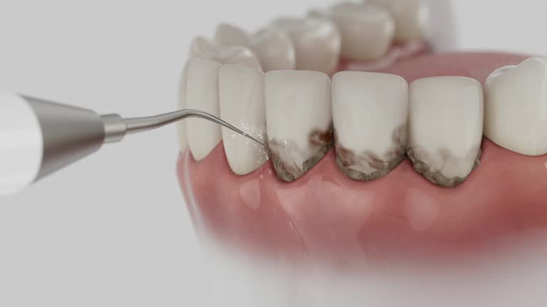 Reliable Dental Implants contractor in Ardmore, OK by Smile Center Dentistry